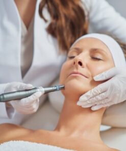 MICRONEEDLING